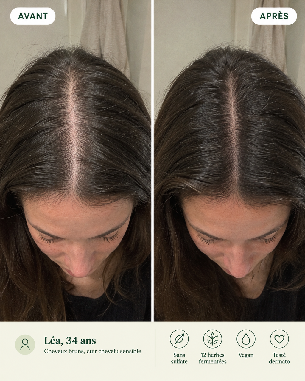Avant après cheveux plus denses